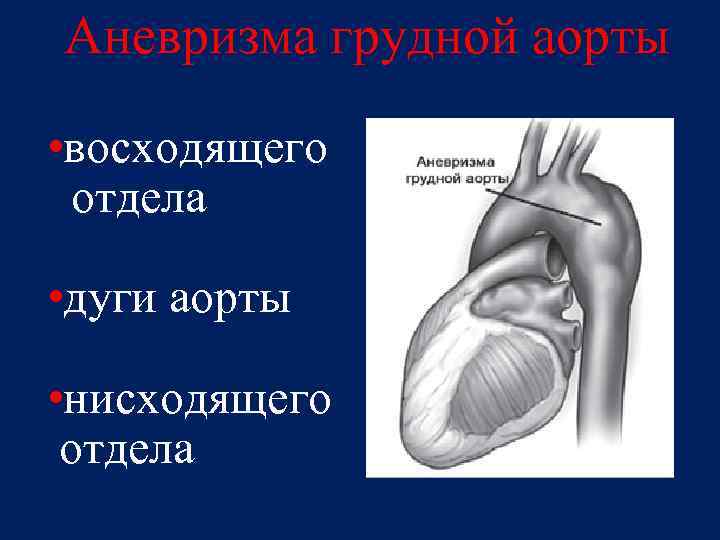 Аневризма восходящей аорты операция