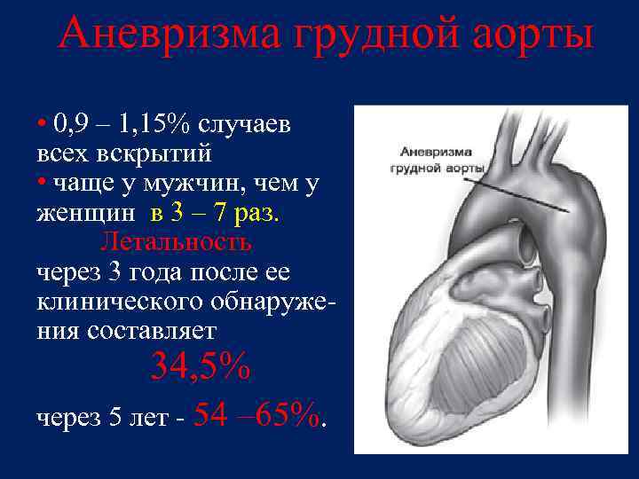 Аневризма аорты это