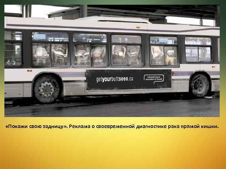  «Покажи свою задницу» . Реклама о своевременной диагностике рака прямой кишки. 