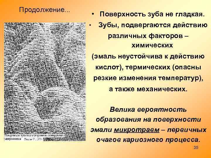 Продолжение. . . • Поверхность зуба не гладкая. • Зубы, подвергаются действию различных факторов