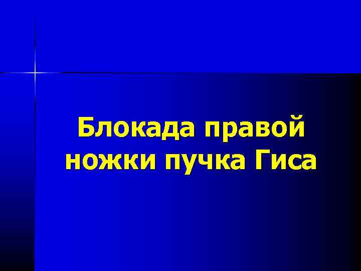 Блокада правой ножки пучка Гиса 