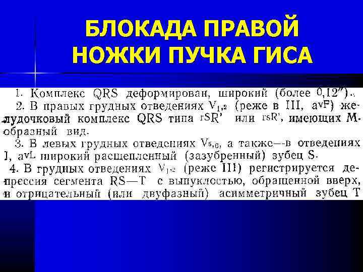 БЛОКАДА ПРАВОЙ НОЖКИ ПУЧКА ГИСА 