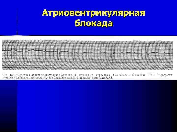 Нарушение ритма карта вызова