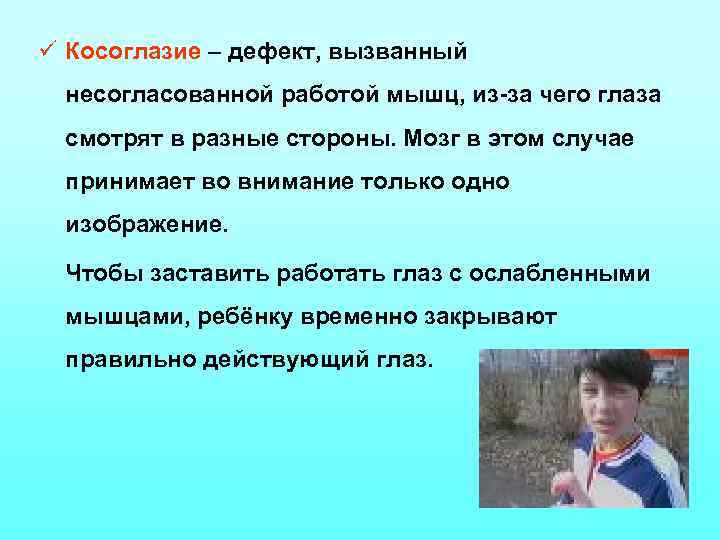 ü Косоглазие – дефект, вызванный несогласованной работой мышц, из-за чего глаза смотрят в разные