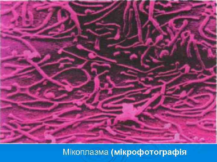 Мікоплазма (мікрофотографія 