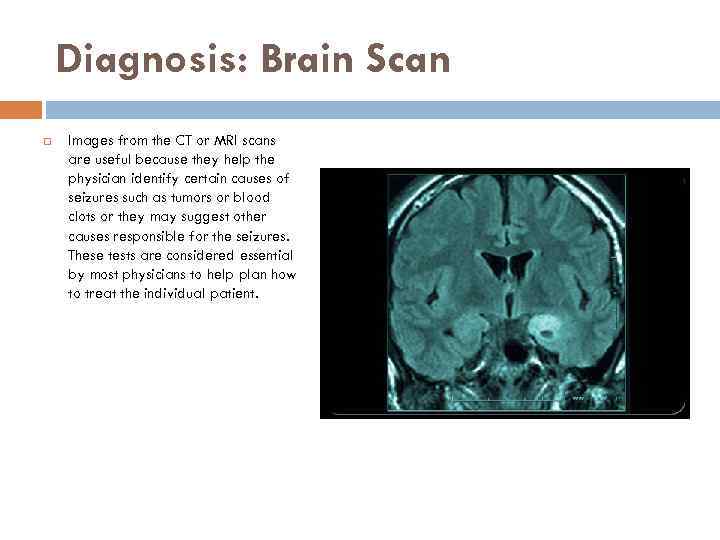 Diagnosis: Brain Scan Images from the CT or MRI scans are useful because they