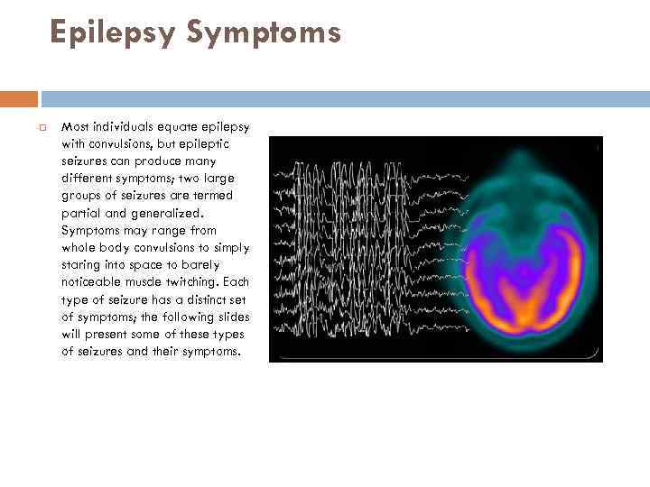 Epilepsy Symptoms Most individuals equate epilepsy with convulsions, but epileptic seizures can produce many