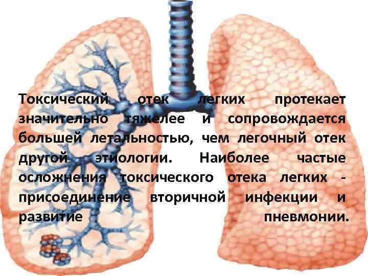 Токсический отек легких протекает значительно тяжелее и сопровождается большей летальностью, чем легочный отек другой