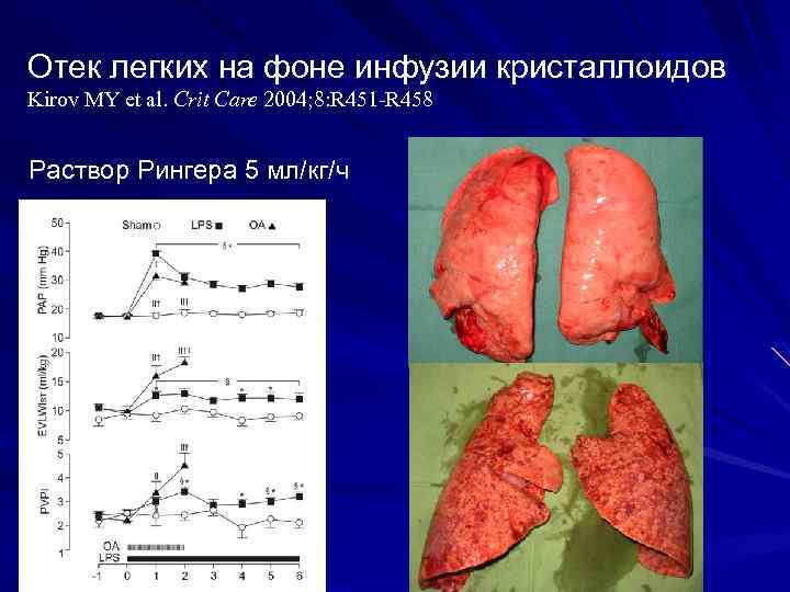 Отек легких на фоне инфузии кристаллоидов Kirov MY et al. Crit Care 2004; 8: