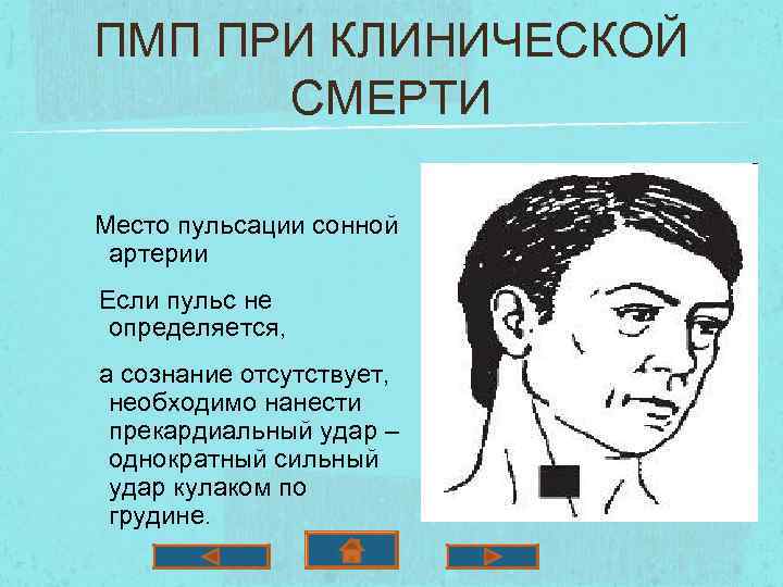 ПМП ПРИ КЛИНИЧЕСКОЙ СМЕРТИ Место пульсации сонной артерии Если пульс не определяется, а сознание