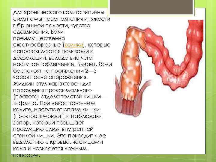 Для хронического колита типичны симптомы переполнения и тяжести в брюшной полости, чувство сдавливания. Боли