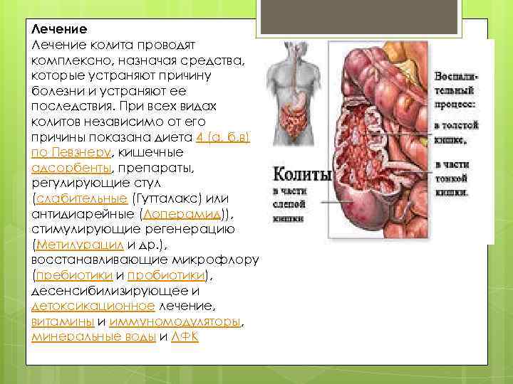 Лечение колита проводят комплексно, назначая средства, которые устраняют причину болезни и устраняют ее последствия.