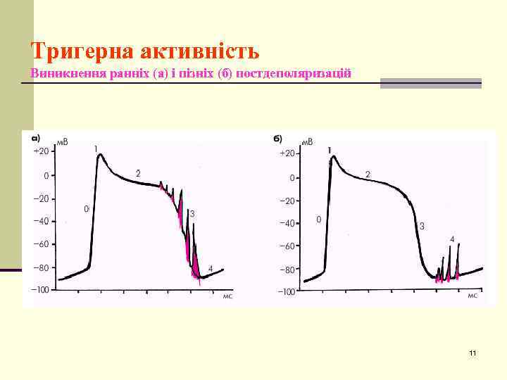 Тригерна активність Виникнення ранніх (а) і пізніх (б) постдеполяризацій 11 