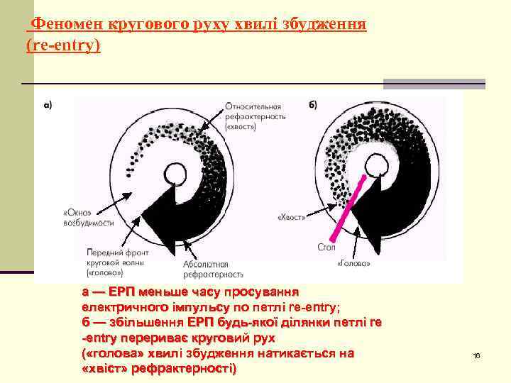 Феномен кругового руху хвилі збудження (re-entry) а — ЕРП меньше часу просування електричного імпульсу