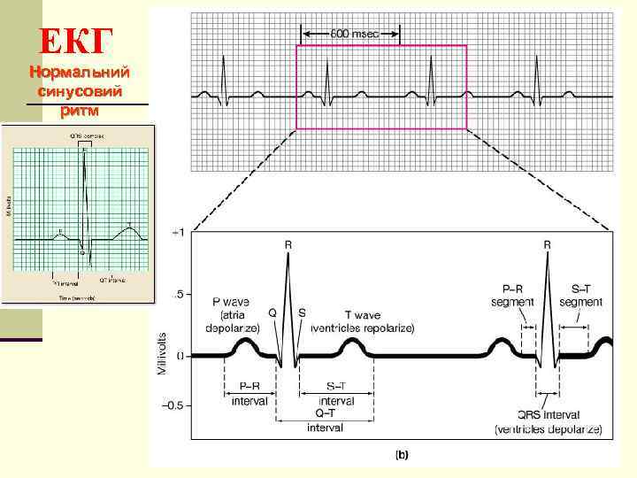 EКГ Нормальний синусовий ритм 24 