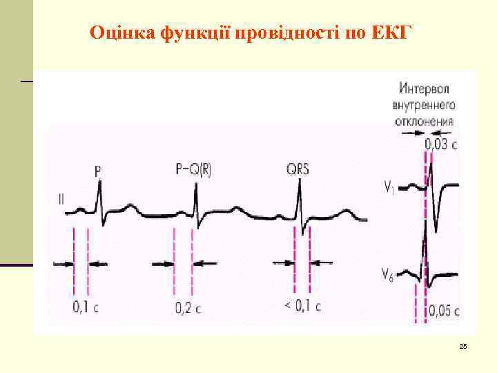 Оцінка функції провідності по ЕКГ 25 