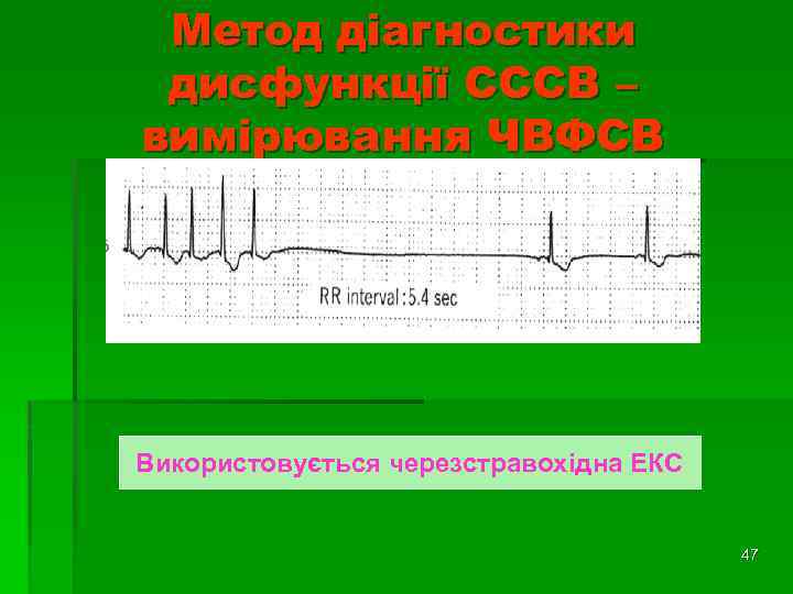 Метод діагностики дисфункції СССВ – вимірювання ЧВФСВ Використовується черезстравохідна ЕКС 47 