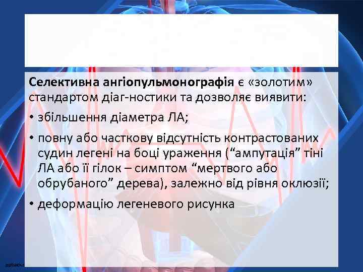Селективна ангіопульмонографія є «золотим» стандартом діаг-ностики та дозволяє виявити: • збільшення діаметра ЛА; •
