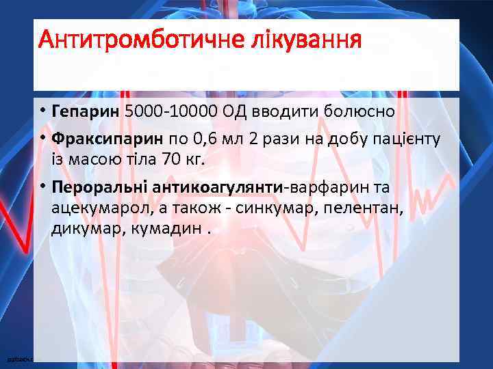 Антитромботичне лікування • Гепарин 5000 -10000 ОД вводити болюсно • Фраксипарин по 0, 6
