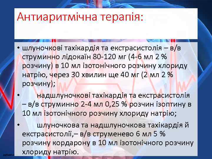 Антиаритмічна терапія: • шлуночкові тахікардія та екстрасистолія – в/в струминно лідокаїн 80 -120 мг