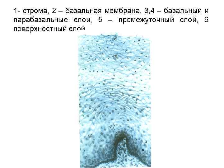 1 - строма, 2 – базальная мембрана, 3, 4 – базальный и парабазальные слои,