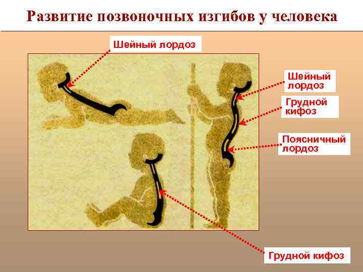 Развитие позвоночных изгибов у человека Шейный лордоз Грудной кифоз Поясничный лордоз Грудной кифоз 