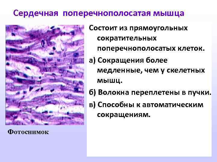 Сердечная поперечнополосатая мышца Состоит из прямоугольных сократительных поперечнополосатых клеток. а) Сокращения более медленные, чем