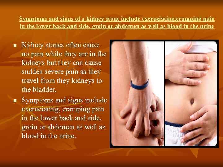 Symptoms and signs of a kidney stone include excruciating, cramping pain in the lower