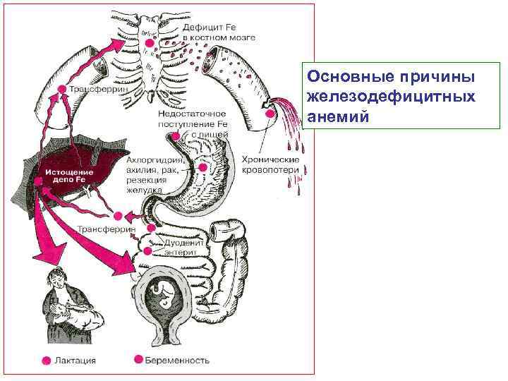 Основные причины железодефицитных анемий 