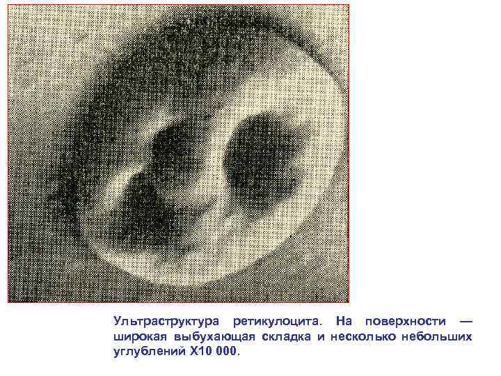 Ультраструктура ретикулоцита. На поверхности — широкая выбухающая складка и несколько небольших углублений X 10