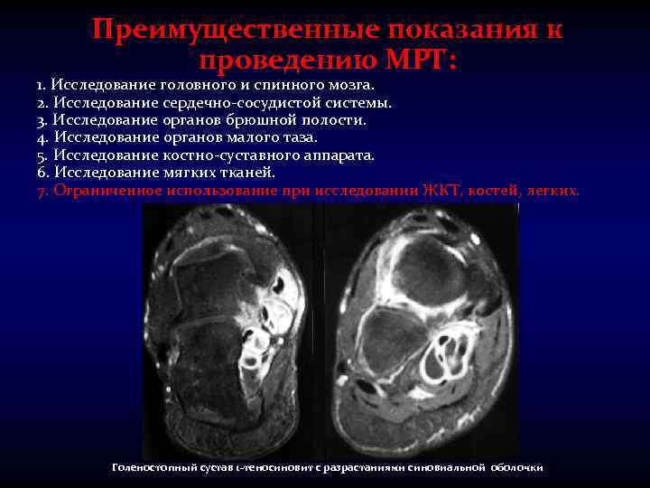 Преимущественные показания к проведению МРТ: 1. Исследование головного и спинного мозга. 2. Исследование сердечно-сосудистой