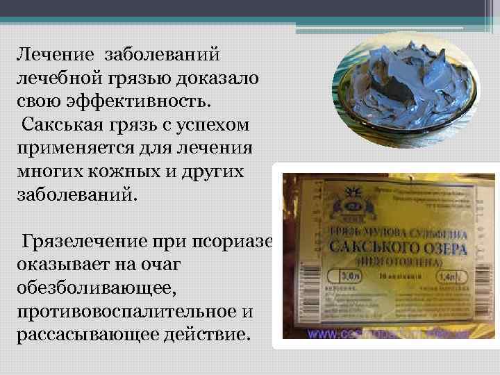 Лечение заболеваний лечебной грязью доказало свою эффективность. Сакськая грязь с успехом применяется для лечения