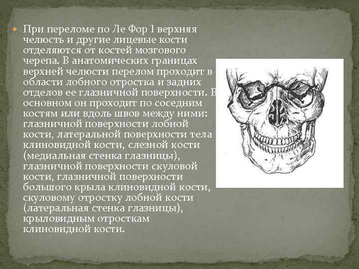  При переломе по Ле Фор I верхняя челюсть и другие лицевые кости отделяются