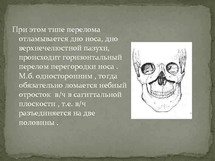 При этом типе перелома отламывается дно носа, дно верхнечелюстной пазухи, происходит горизонтальный перелом перегородки