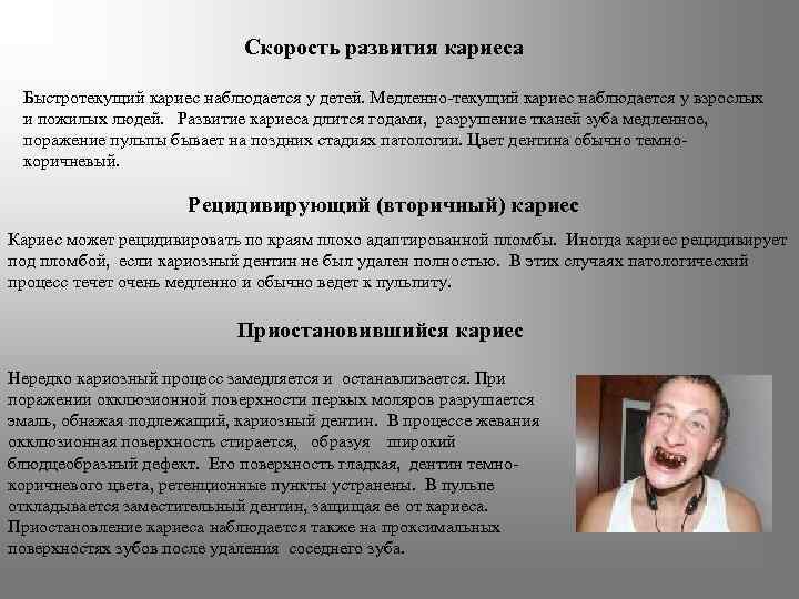 Скорость развития кариеса Быстротекущий кариес наблюдается у детей. Медленно-текущий кариес наблюдается у взрослых и