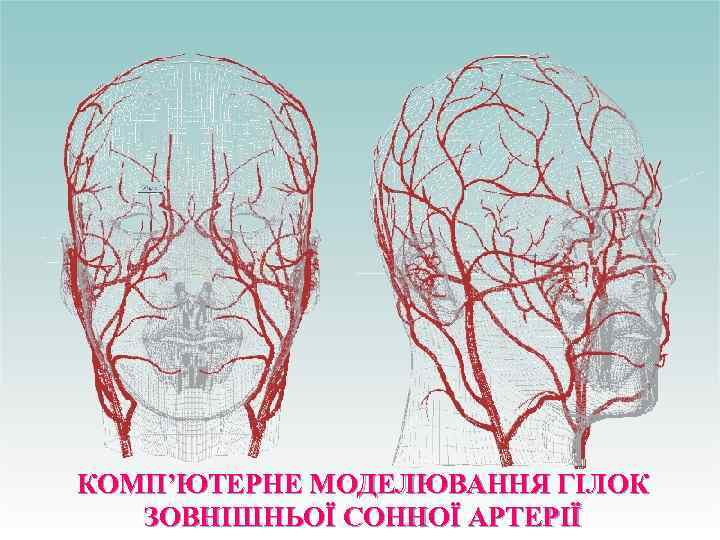 КОМП’ЮТЕРНЕ МОДЕЛЮВАННЯ ГІЛОК ЗОВНІШНЬОЇ СОННОЇ АРТЕРІЇ 
