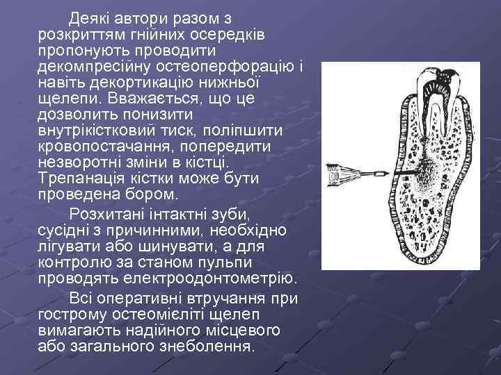 Деякі автори разом з розкриттям гнійних осередків пропонують проводити декомпресійну остеоперфорацію і навіть декортикацію