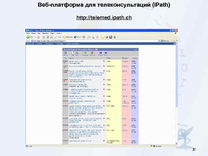 Веб-платформа для телеконсультаций (i. Path) http: //telemed. ipath. ch 30 