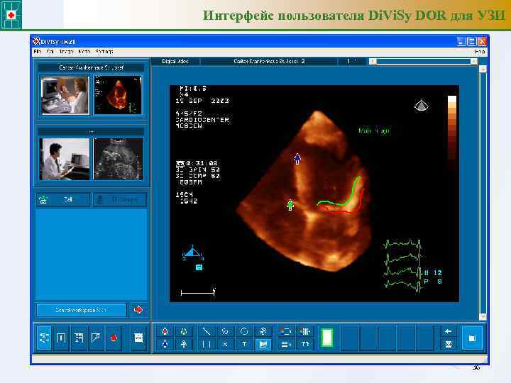 Интерфейс пользователя Di. Vi. Sy DOR для УЗИ 36 