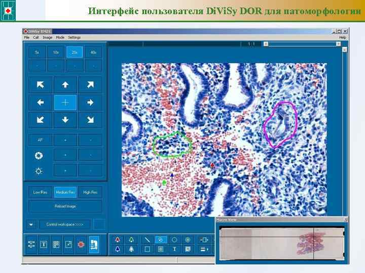 Интерфейс пользователя Di. Vi. Sy DOR для патоморфологии 39 