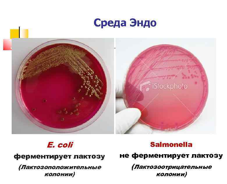 Среда Эндо E. coli Salmonella ферментирует лактозу (Лактозоположительные не ферментирует лактозу колонии) (Лактозоотрицательные колонии)