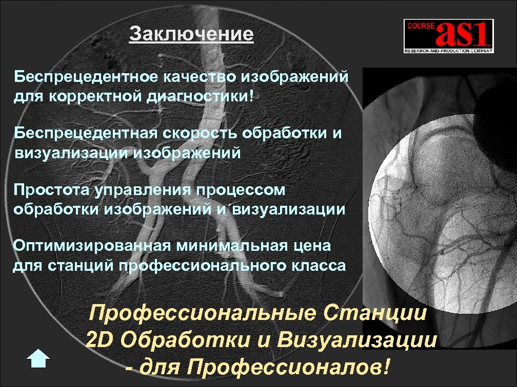 Заключение Беспрецедентное качество изображений для корректной диагностики! Беспрецедентная скорость обработки и визуализации изображений Простота