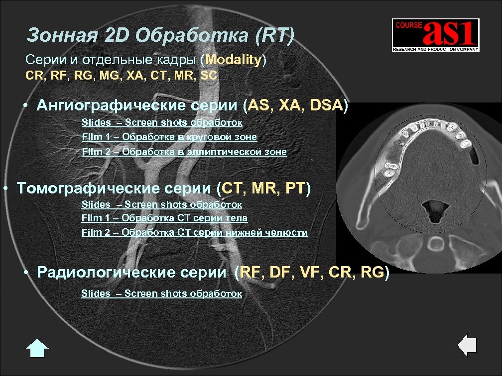 Зонная 2 D Обработка (RT) Серии и отдельные кадры (Modality) CR, RF, RG, MG,