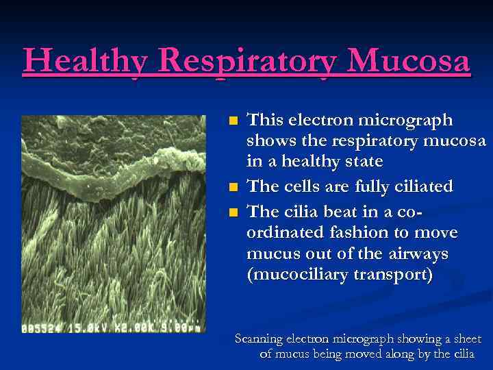 Healthy Respiratory Mucosa n n n This electron micrograph shows the respiratory mucosa in