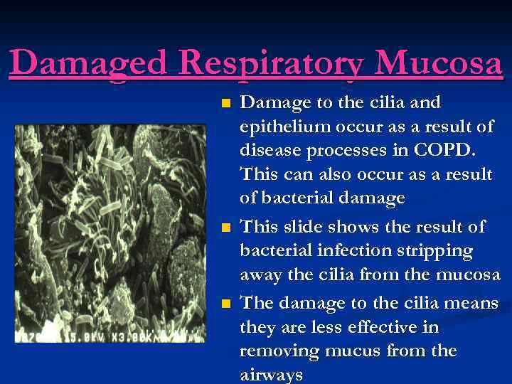 Damaged Respiratory Mucosa n n n Damage to the cilia and epithelium occur as