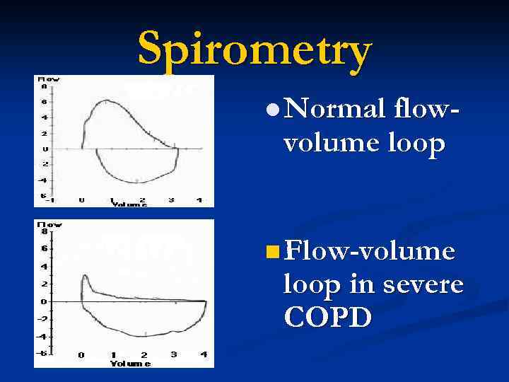 Spirometry l Normal flow- volume loop n Flow-volume loop in severe COPD 