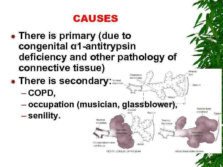 CAUSES There is primary (due to congenital α 1 -antitrypsin deficiency and other pathology