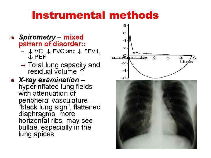 Instrumental methods Spirometry – mixed pattern of disorder: : – ↓ VC, ↓ FVC