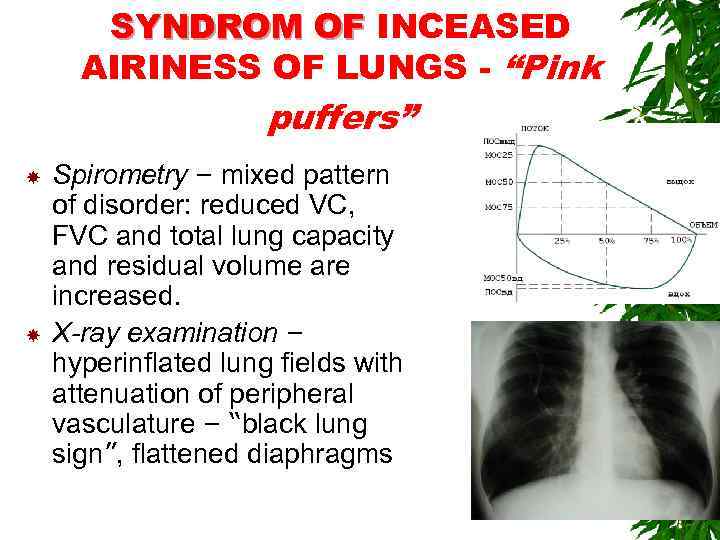 SYNDROM OF INCEASED AIRINESS OF LUNGS - “Pink puffers” Spirometry – mixed pattern of