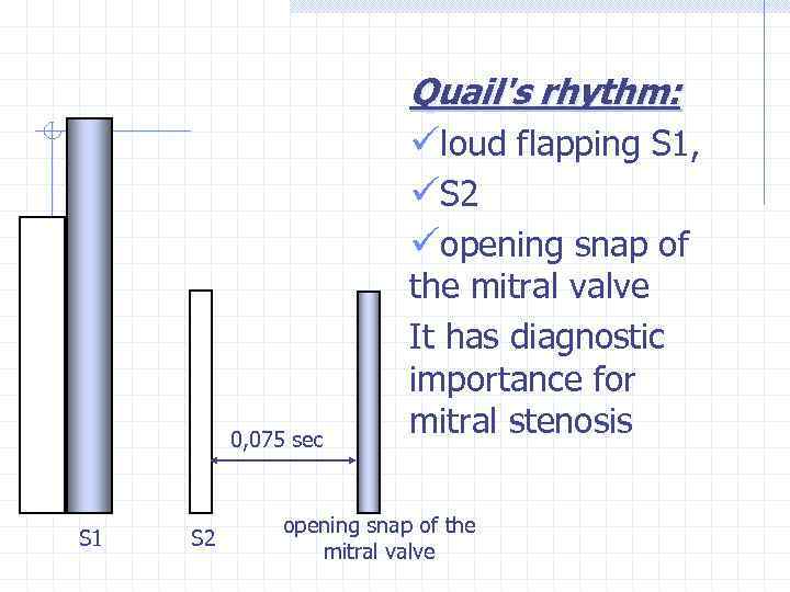 Quail's rhythm: üloud flapping S 1, üS 2 üopening snap of 0, 075 sec